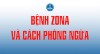 Bệnh zona và cách phòng ngừa